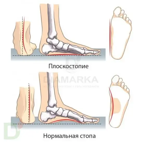 Стельки ортопедические каркасные, текстиль, TRIO FW-607